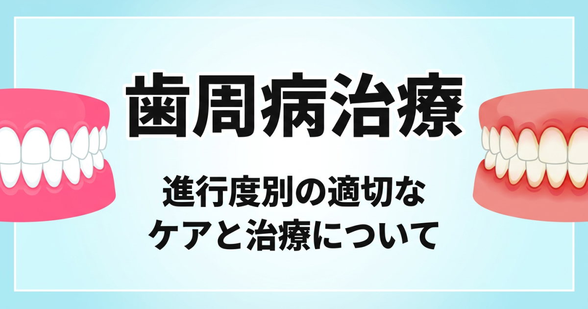 歯周病は治る？治らない？　進行度別に見る歯周病治療